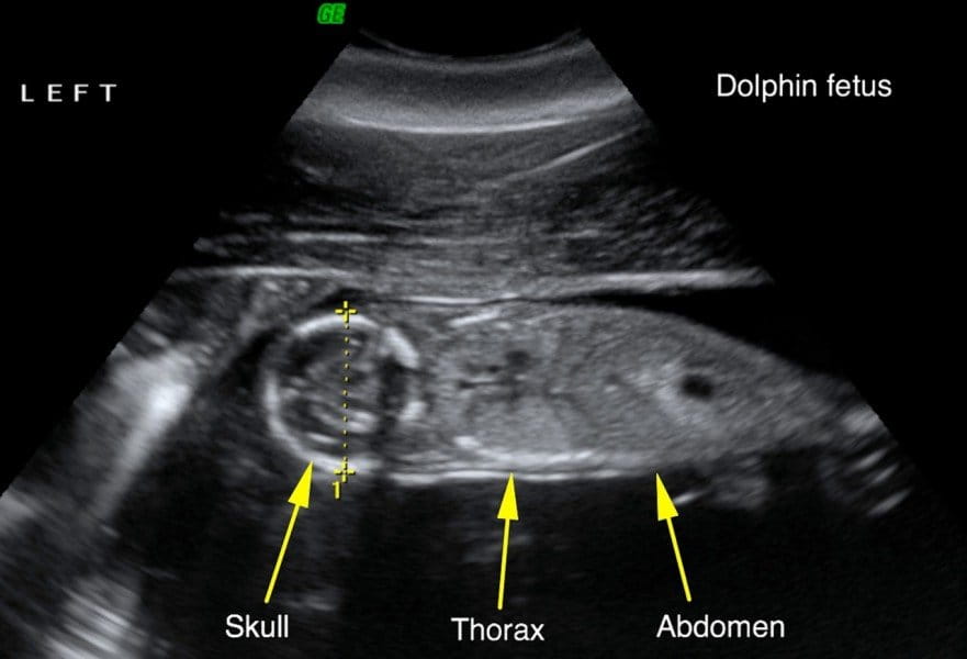 Reproductive ultrasound image of dolphin Y37 showing an approximately 18-week gestational age fetus in a longitudinal plane, acquired in August of 2011.  Dotted line shows the skull biparietal diameter, which is used to estimate gestational age and parturition date.  Boat-based surveys documented that the pregnancy was successful.  Dolphin Y37 was seen with a live calf in both April and August of 2012. Image by Dr. Cynthia Smith, National Marine Mammal Foundation.