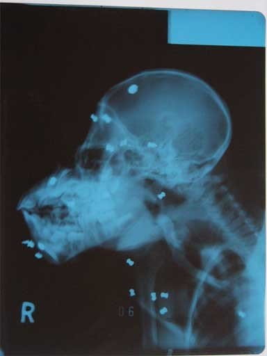 X-ray of gun pellets in Leuser’s skull. Photo courtesy of SOCP