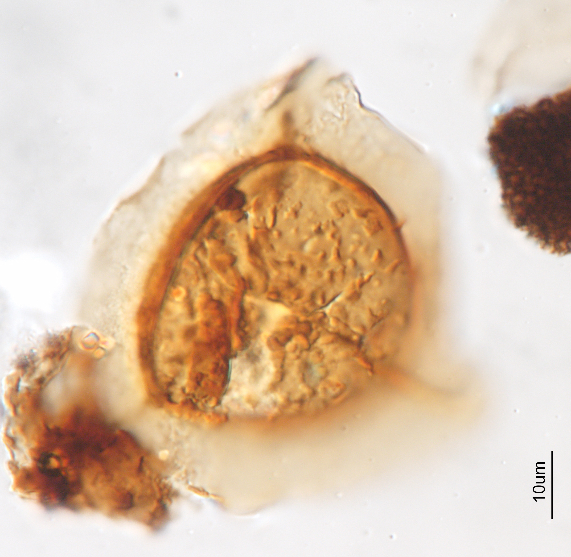 A fern spore collected from late Cretaceous rocks in the Guaduas Formation in Colombia, viewed under the microscope.