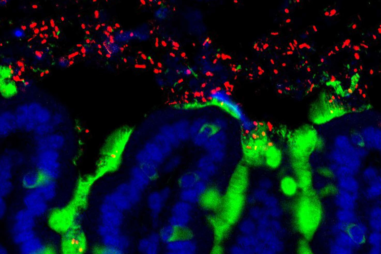 Plants and animals provide a home to an invisible community of microbes, known as the microbiome. 