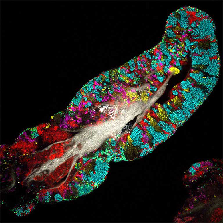 A microbial community on the human tongue. Each color represents a different type of microbe. 