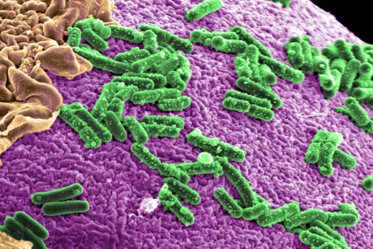 In lab animals and humans, dysfunction of the gut microbiome has been linked to digestive diseases.