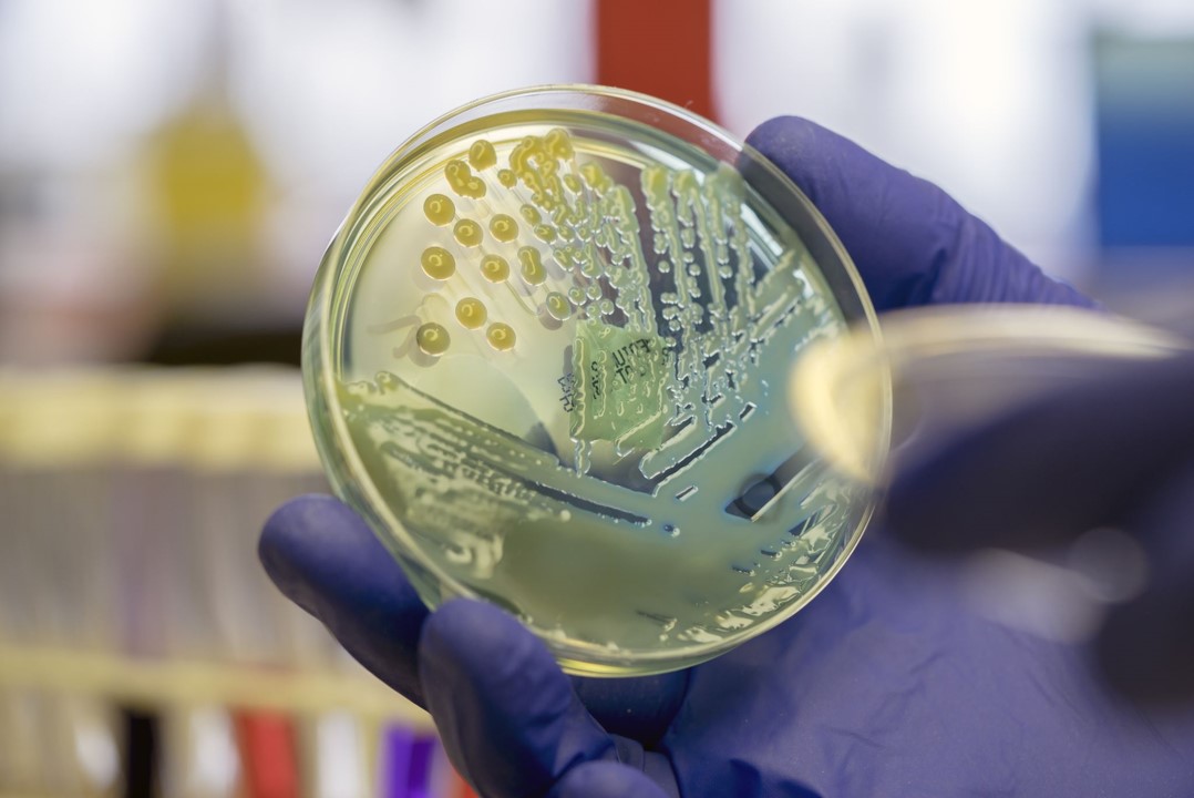 Joanna Sadler and her colleagues have engineered E. coli to convert PET plastic into vanillin