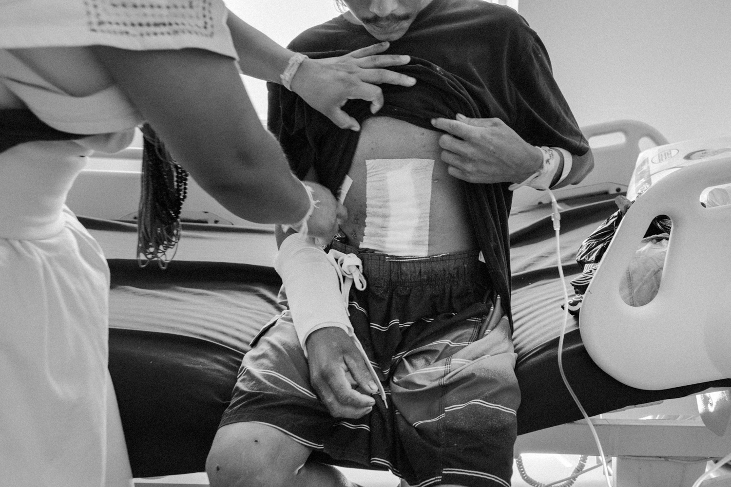 A close-up shot of a young Arhuaco man receiving medical treatment at the Clínica El Prado in Santa Marta, Colombia. He is showing the severe shrapnel wounds on his right arm and abdomen, caused by drone-delivered bombs that detonated during an armed confrontation inside his community. The explosion sent splinters that cut open his arm and penetrated his abdomen, causing internal damage to vital organs including his stomach, intestine, and colon.