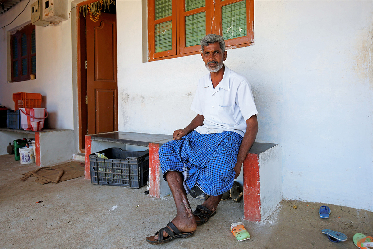 Dorai, a survivor of Russell’s viper bite in Ratnapuri village. Despite spending about lakhs for treatment, he still hasn't recovered completely hindering farming activities. Photo by Abhishek N. Chinnappa.