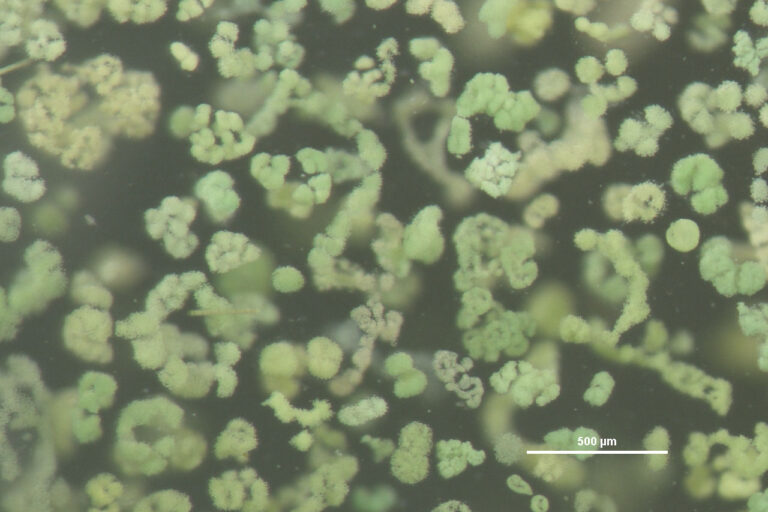 Microcystis algae, as seen under a microscope. Researchers from Kolkata monitored Deepor Beel from November 2024 to February 2025, studying blooms of two common toxin-producing blue-green algae, Planktothrix and Microcystis. While algal blooms are natural, increasing human pressures on wetlands are making them more frequent and abundant, say the researchers. Representative image by NOAA Great Lakes Environmental Research Laboratory via Wikimedia Commons (CC BY-SA 2.0).